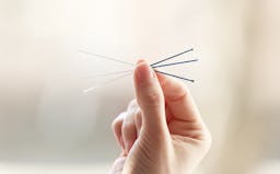 Acupuncture - Science or Sorcery?